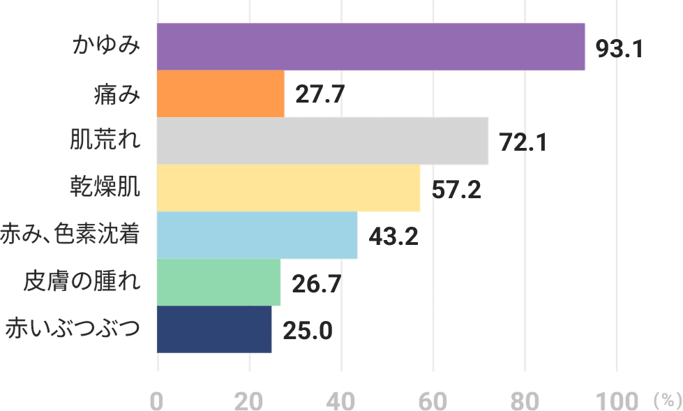histogram