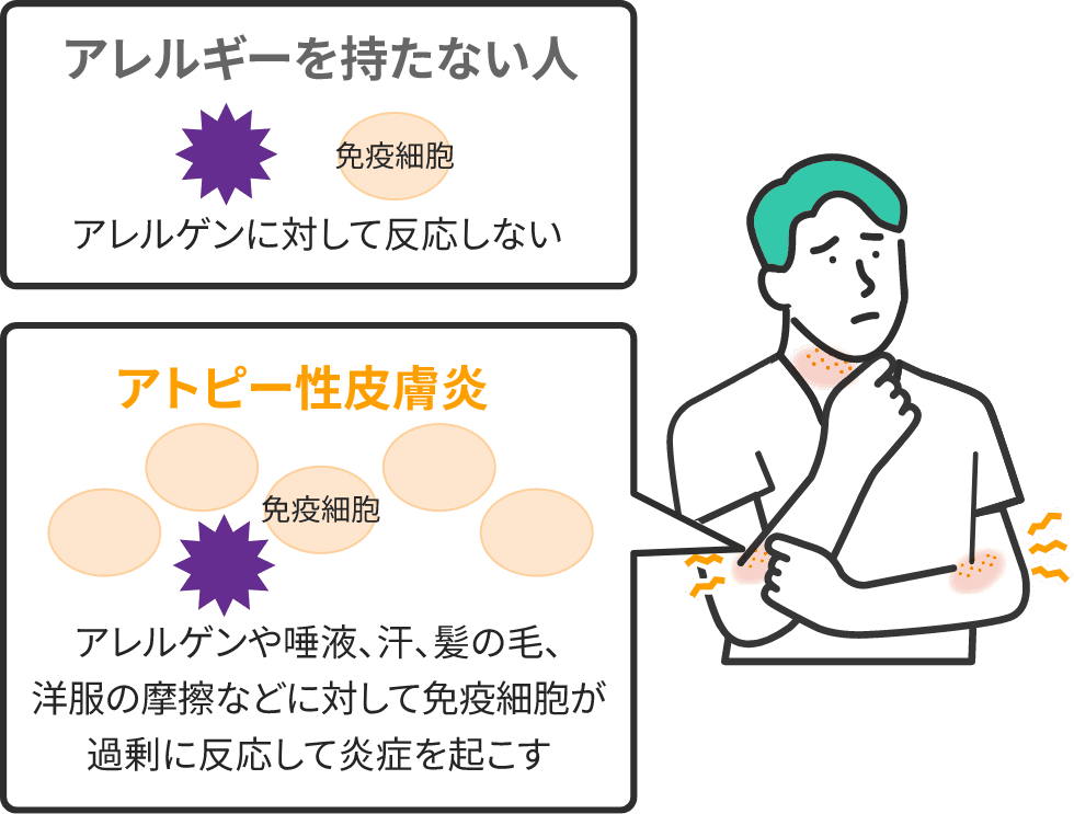 どのように扱われますか?